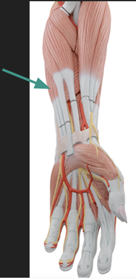 <p>flexor digitorum superficialis m.</p><p>O: medial epicondyle (humerus), UCL, ulnar coronoid process<br>I: middle phalange of digits 2-5<br>A: flex digits at MCP and IP<br>Inn: median n.</p>