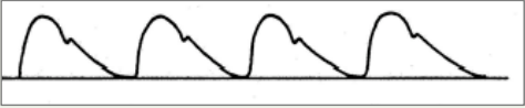<p>Pressure of the pulse: normal</p><p>Contour: smooth and rounded</p>