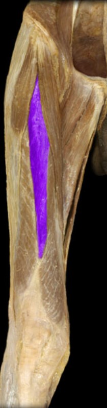 <p>Name the muscle highlighted (two words - all lowercase)</p>