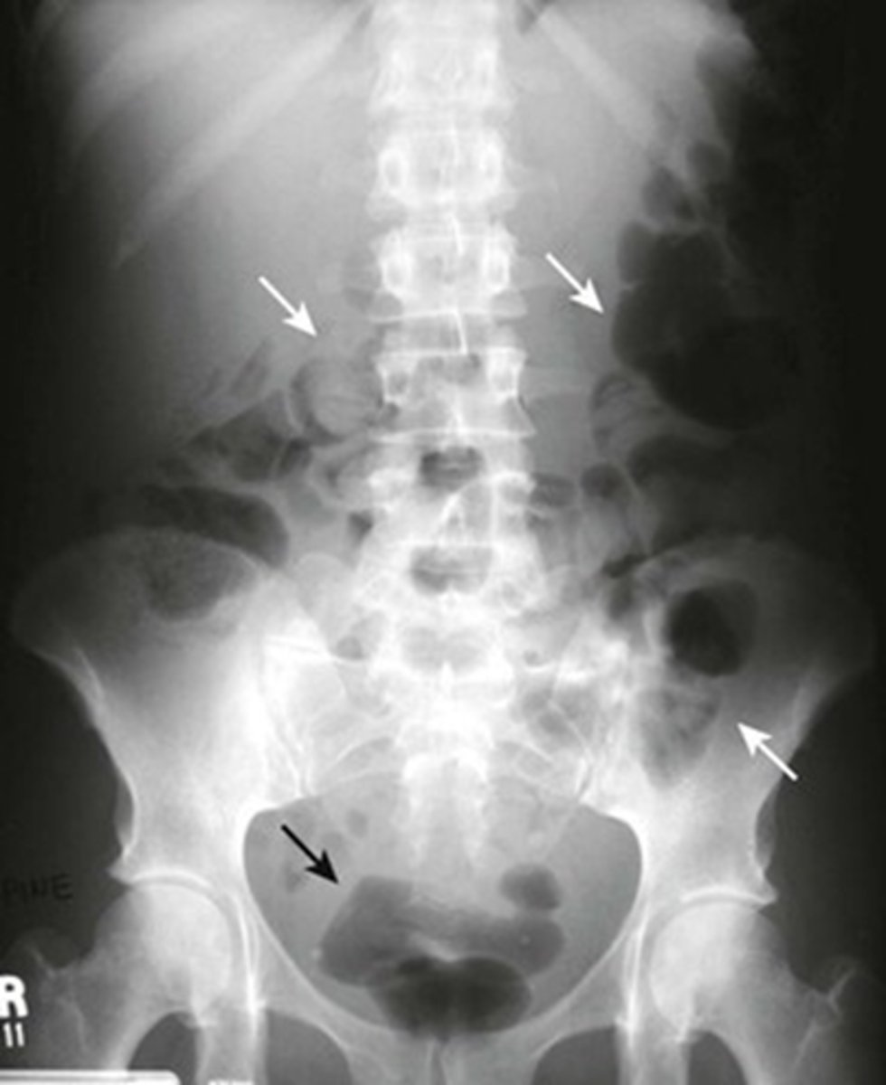 knowt flashcard image