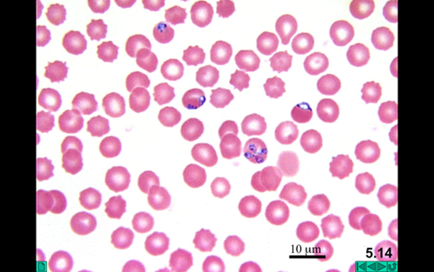 <p>- Single-celled</p><p>- Parasite</p><p>- Intracellular (Inside host)</p><p>- Causes malaria</p><p>- Non-motile</p><p>3 multiple choice options</p>