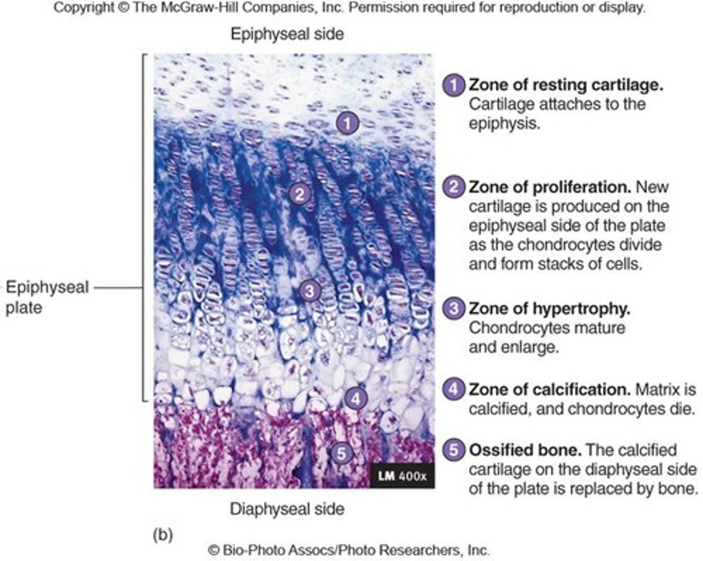 <p>resting (quiescent) , proliferation (growth), and hypertrophic zone, calcification, ossification zone</p>