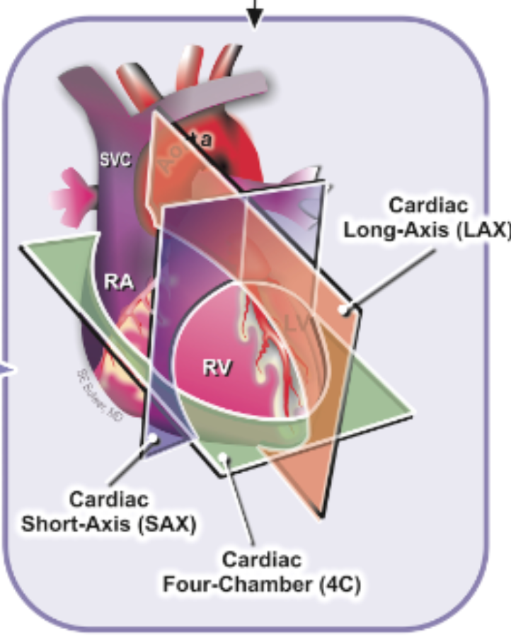 <p>LAX</p>