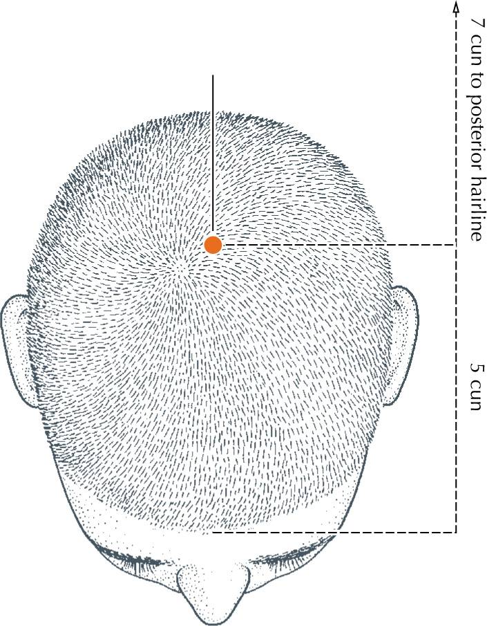 <p>DU-20</p>