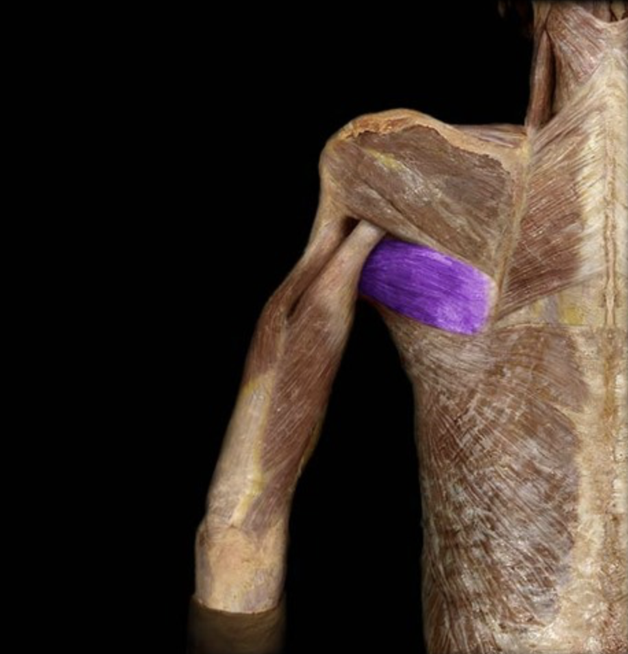 <p><em>table 1</em></p><p><em>I: intertubercular (bicipital) groove of humerus</em></p>