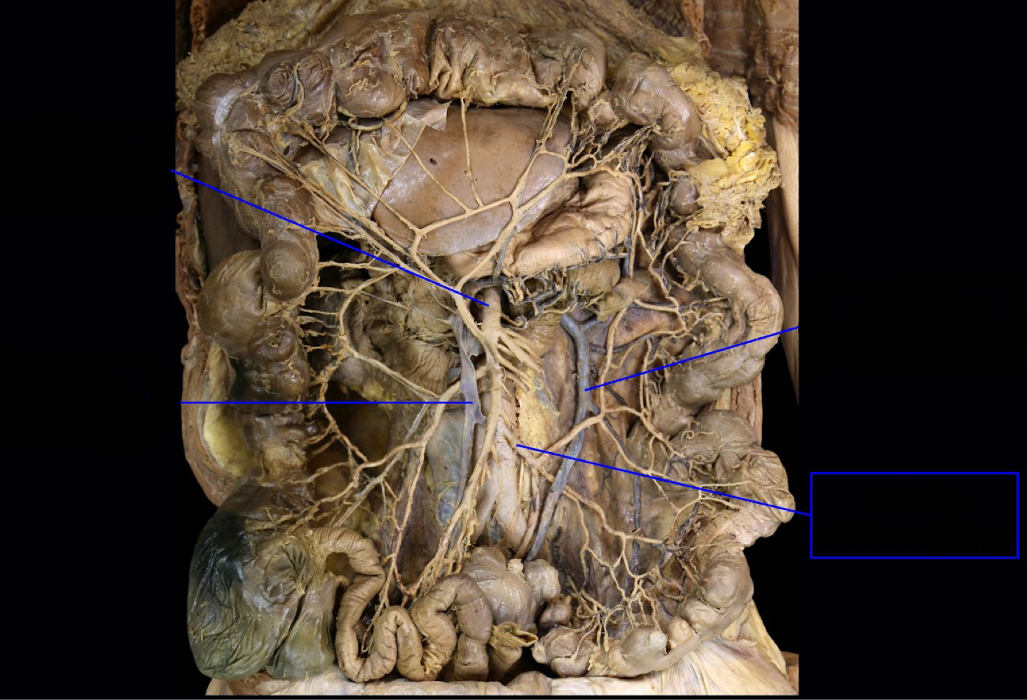 <p>what abdominal region does this structure supply?</p>