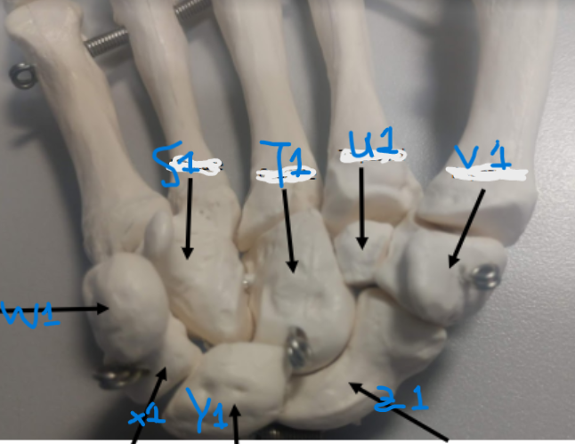 <p>What is U1?</p>