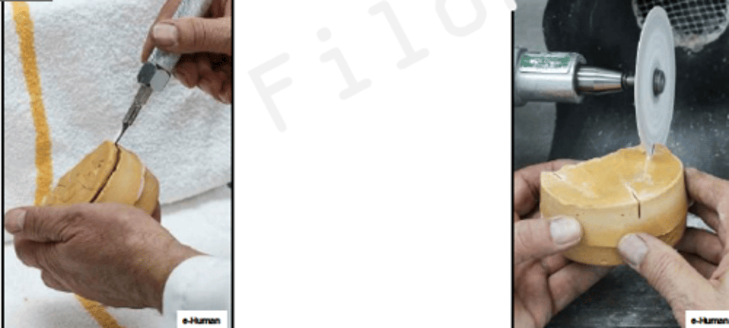 <p>ID the phase:</p>