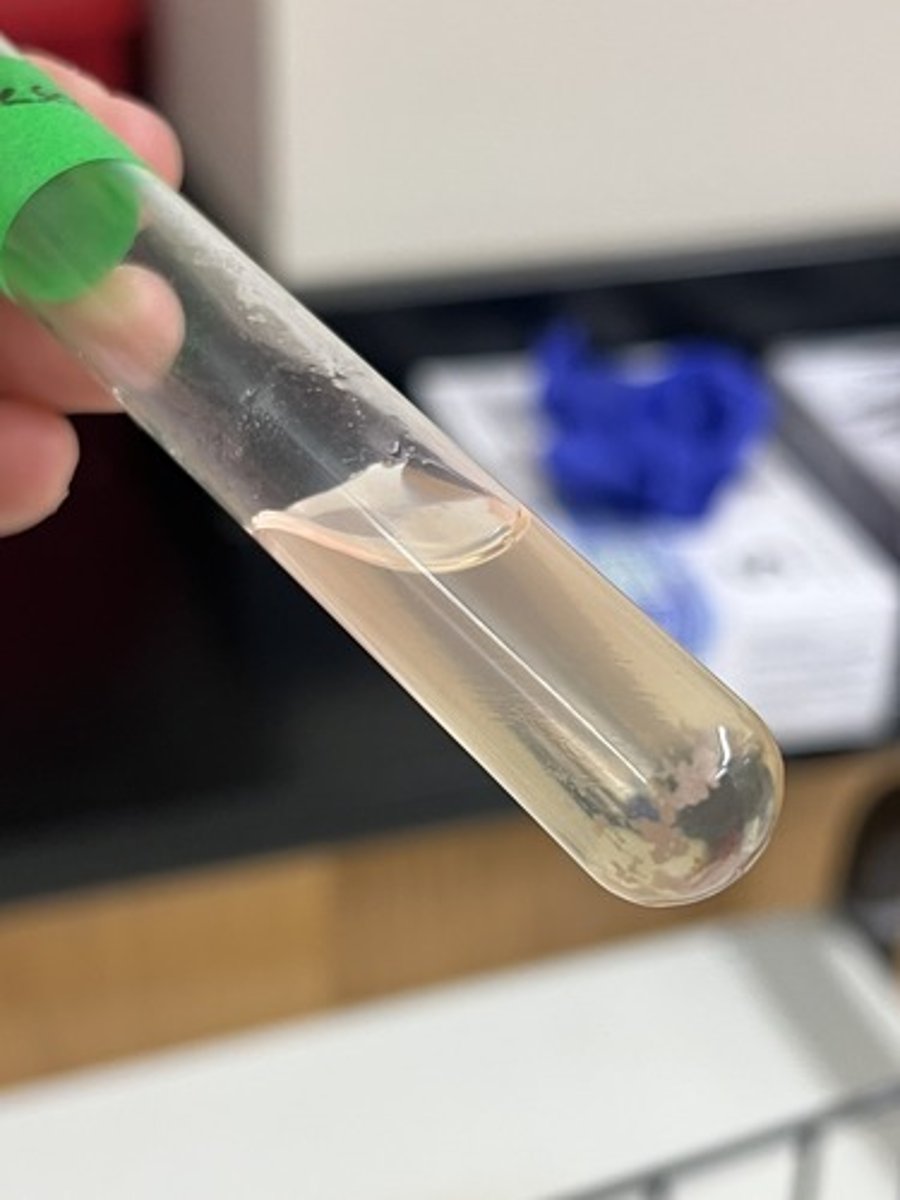 <p>Tests for organisms ability to produce gelatinase to hydrolyze gelatin.</p><p>Positive test (+) - Liquid medium</p>