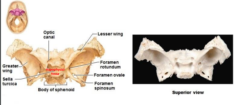 <p>Superior view: </p><ul><li><p>Optic canal</p></li><li><p>Greater wing</p></li><li><p>Sella turcica</p></li><li><p>Hypophysial fossa</p></li><li><p>Body of sphenoid</p></li><li><p>Lesser wing</p></li><li><p>Foramen rotundum</p></li><li><p>Foramen ovale</p></li><li><p>Foramen spinosum</p></li></ul>