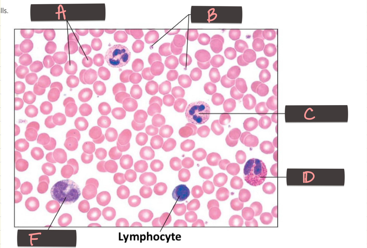 <p>Lymphocyte</p>