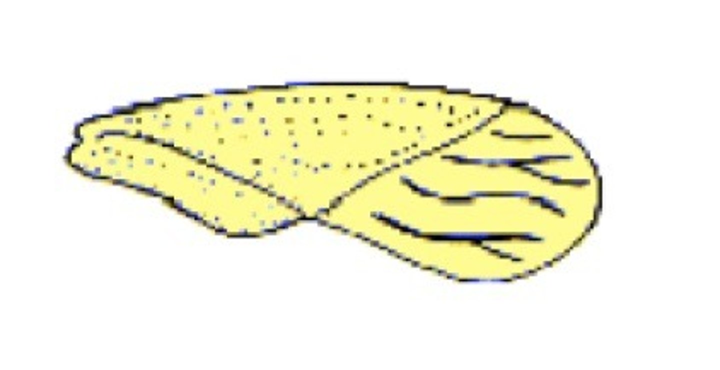 <p>______________ front wings that are leathery or</p><p>parchment-like at the base and membranous near the tip (Hemiptera)</p>