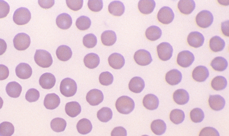 <p>spp wc has rbc similar in size to horses, lack central pallor, and shows a small degree of anisocytosis</p><ul><li><p>rare rouleaux formation</p></li><li><p>polychromatophils are not usually observed, but release reticulocytes in response to anemia</p></li><li><p>show marked poikilocytosis, thrombocytosis, and microcytosis (til 1 yr of age due to iron deficiency)</p></li><li><p>life span: 160 days</p></li></ul><p></p>