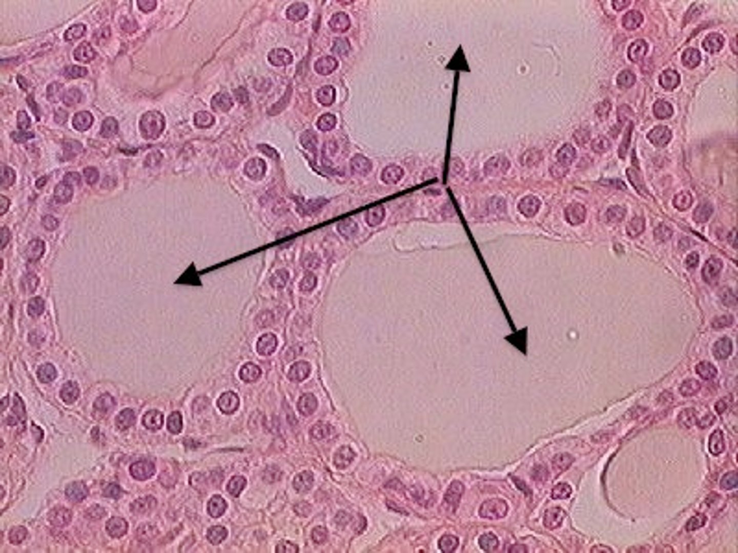 <p>follicle</p>