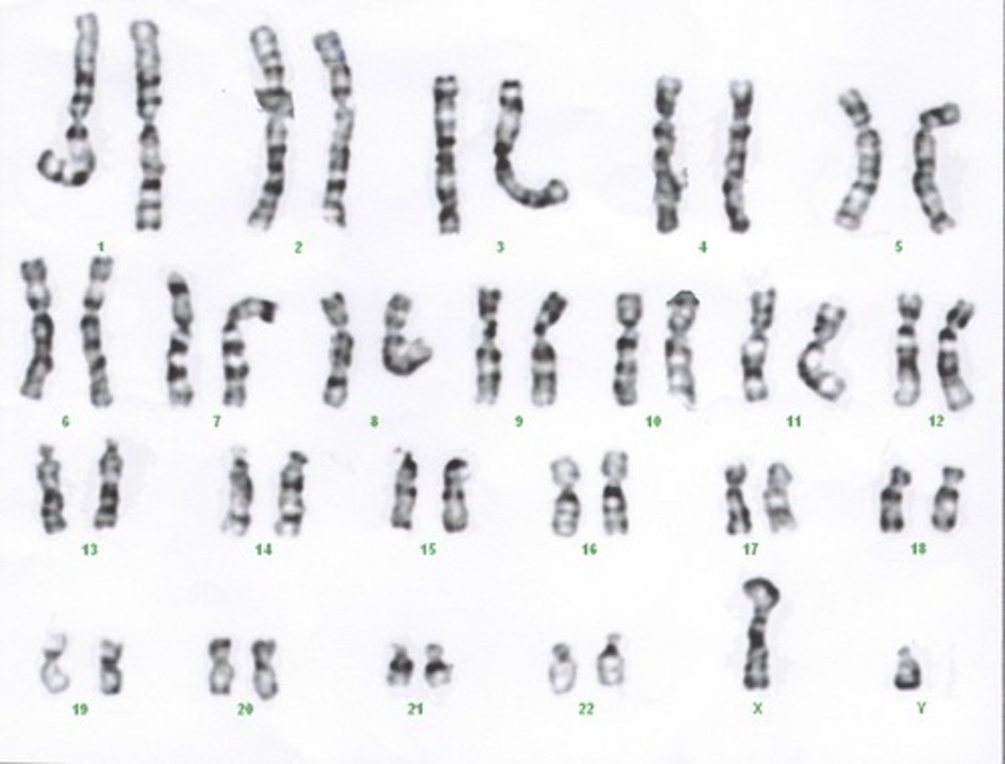 <p>A display of the chromosome pairs of a cell arranged by size and shape.</p>