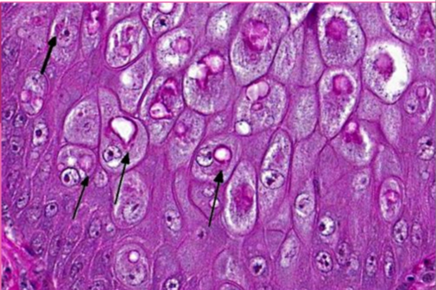 <p>What is this?</p><p>(Options are like, glycogen, lipid, viral, iron inclusions.... options are all the inclusions a cell can have)</p>