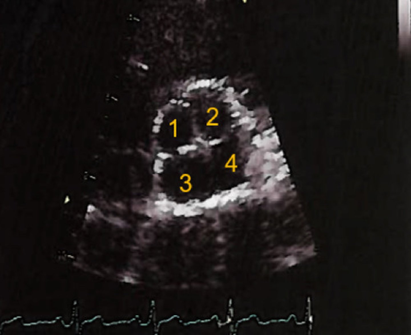 <p>What does this image represent</p>