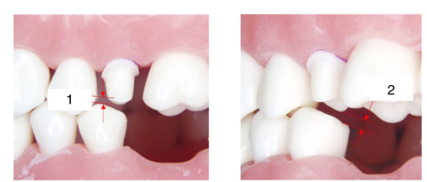 <p>What is the measurement of 2?</p>