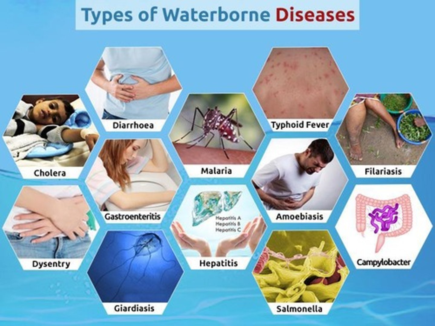 <p>A disease caused by pathogens present in contaminated water.</p>