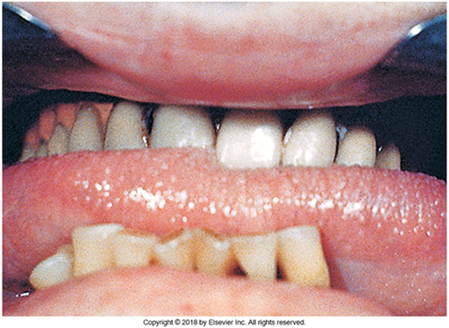 knowt flashcard image