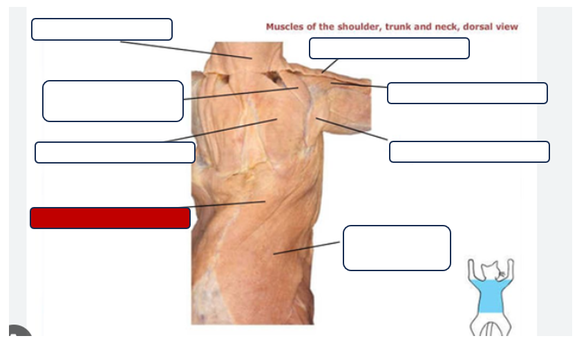 <p>Label the muscle</p>