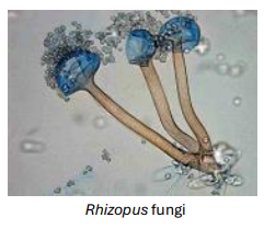 <p>Extremely stable protein toxin</p><p>Associated with, and shed from R. delemar hyphae</p><p>Mucoricin causes:</p><ol><li><p>Organ damage</p></li><li><p>Necrosis (<strong>ribosome inactivation</strong>: depurination of ribosomal RNA)</p></li><li><p>Haemorrhage and vascular leakage </p></li><li><p>Immune cell infiltration</p></li></ol><p></p>