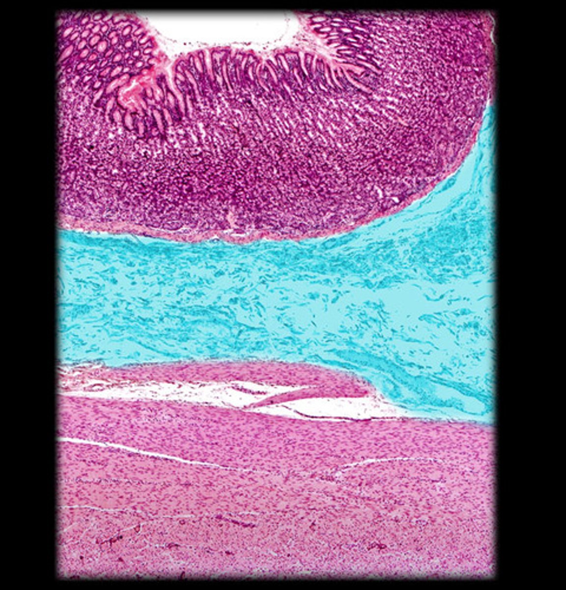 <p>thicker areas of this layer are the bases of rugae</p>