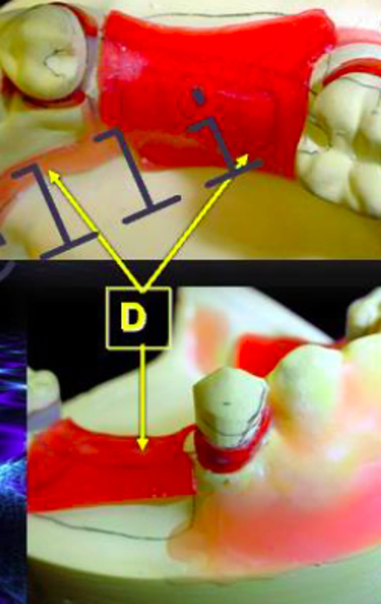 <p>ID the type of block out at D:</p>