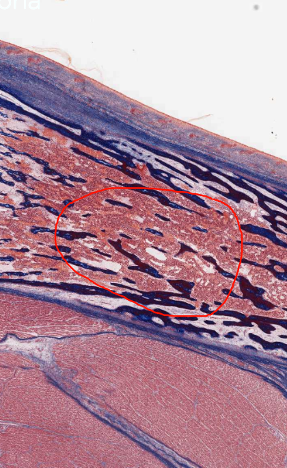 <ol start="13"><li><p>What best identifies this space</p><p>A. epiphysis</p><p>B.metaphysis</p><p>C.Primary Ossification Centre</p><p>D.Secindary Ossification Centre</p></li></ol><p></p>