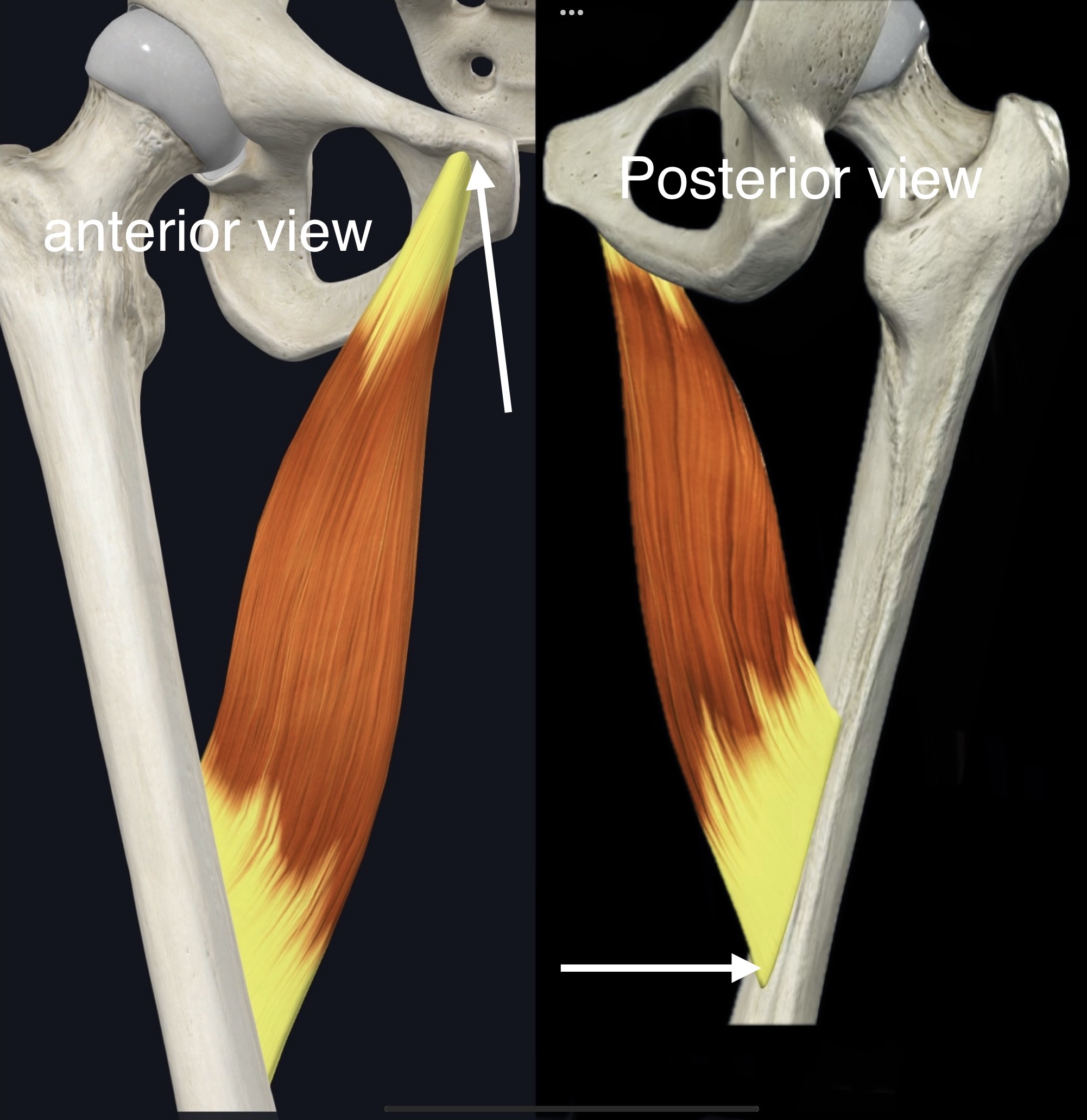<p>Name the muscle, origin and insertion</p>