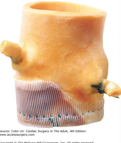 <p>porcine aortic valves or bovine pericardium </p>
