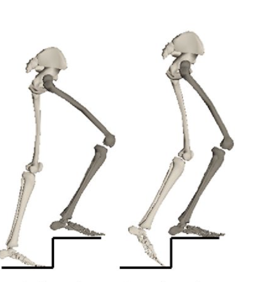 <ul><li><p>Weight Acceptance to Pull up of Stance Phase</p></li><li><p>Hip motion</p></li><li><p>Gluteus maximus, Gluteus medius, Semitendinosus</p></li><li><p>Concentric</p></li></ul><p></p>