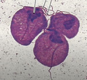 <p>Identify the parasite (specifically a flagellate) shown in the picture, which is causative agent of the STD trichomoniasis.</p>