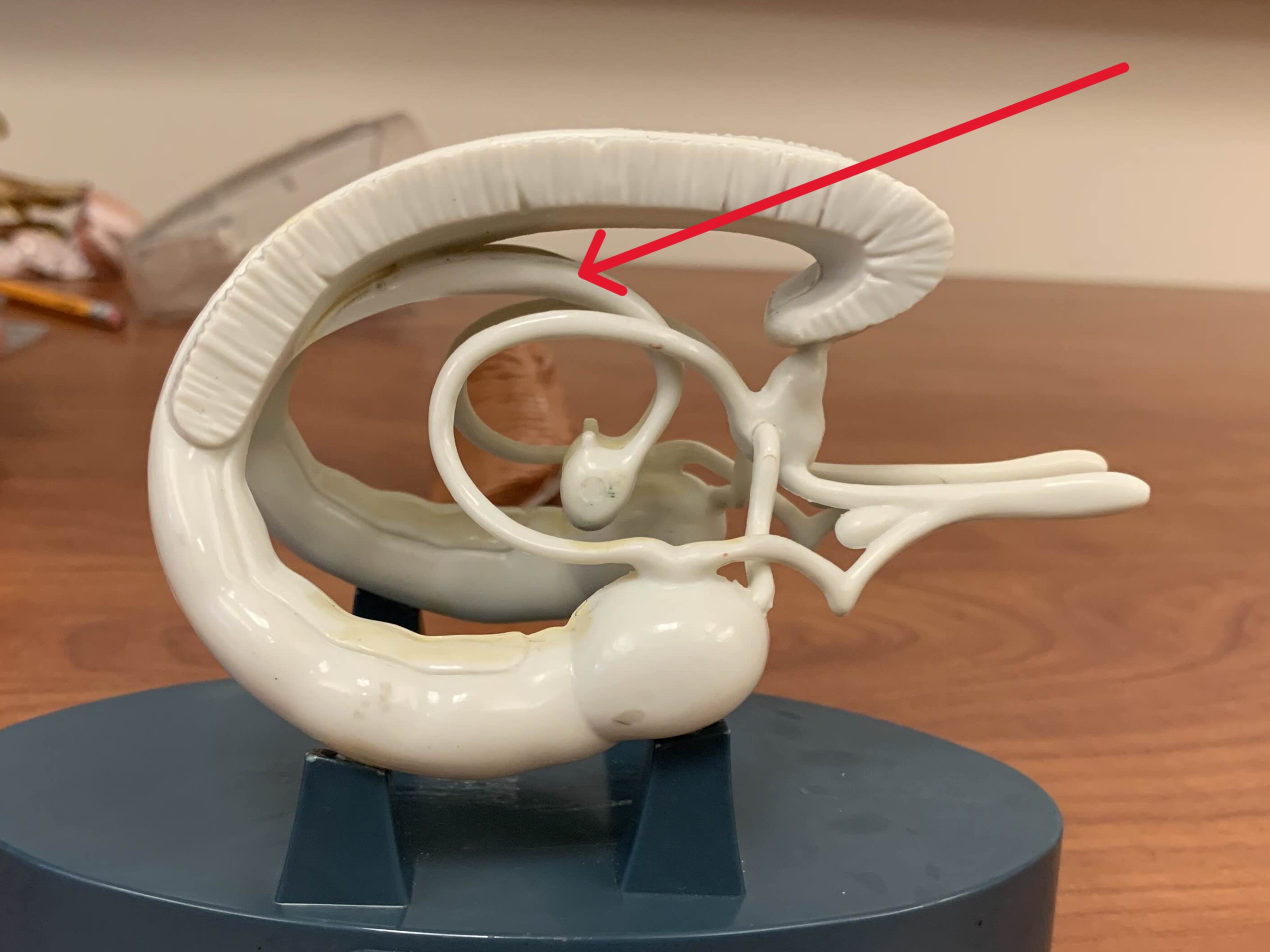 <p>Which part of the brain is:</p><ul><li><p>Inferior to corpus callosum</p></li><li><p>Superior to third ventricle</p></li></ul><p></p>