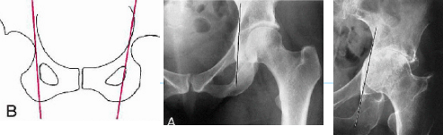 <p>Q what is the name of this measurement? and what is the average + range?</p>