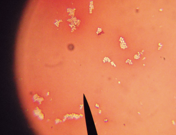 <p>What kind of stain, + or -, what kind of bacteria?</p>