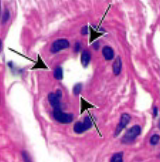 <p>what type of artery is this? 1-2 layers of smooth muscle, thin tunica adventitia, direct blood flow</p>