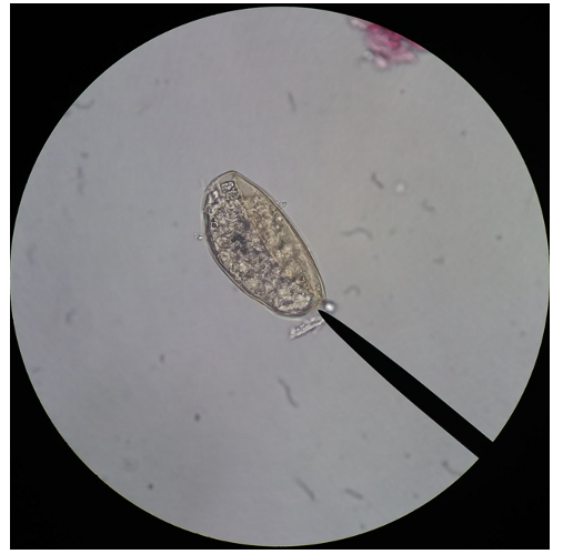 <p>What type of worm is in this image?</p>