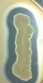 <p>Is this a positive or negative&nbsp;Protein Hydrolysis (Skim milk agar) test?</p>