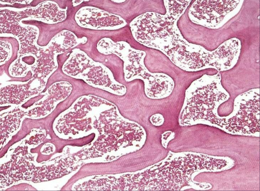 <p>spongy bone connective tissue</p>