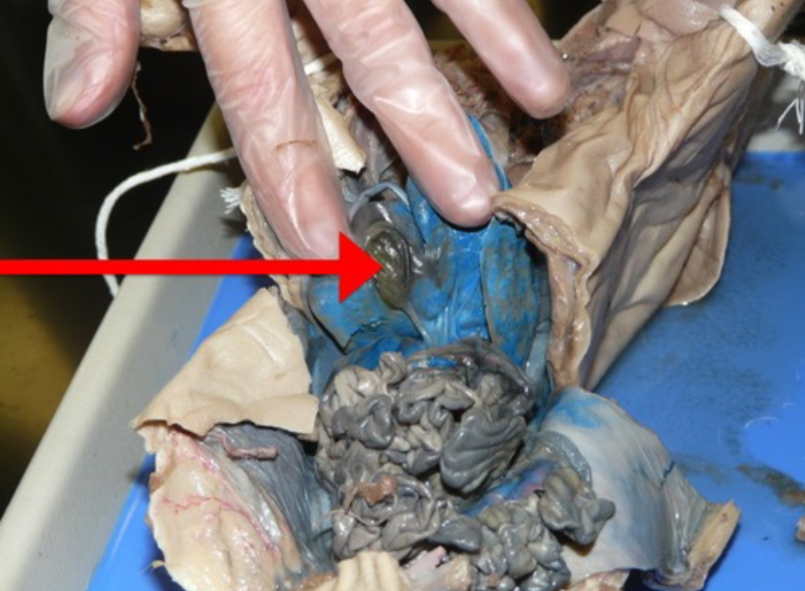 <p>Sac-like organ that stores bile produced by the liver.</p>