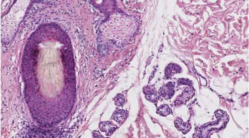 <p>The sweat glands in the image are considered......</p><p>a. Sebaceous glands</p><p>b. Apocrine</p><p>c. Eccrine</p><p>d. Arrector Pili</p><p><br></p>