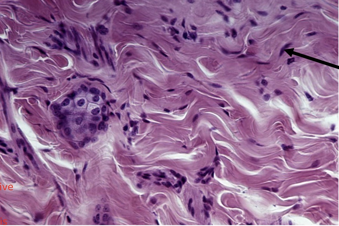 <p>Identify the type of tissue and the<br>structure at the arrow</p>