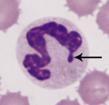 <p><span>Visible inactivated X chromosome</span></p>