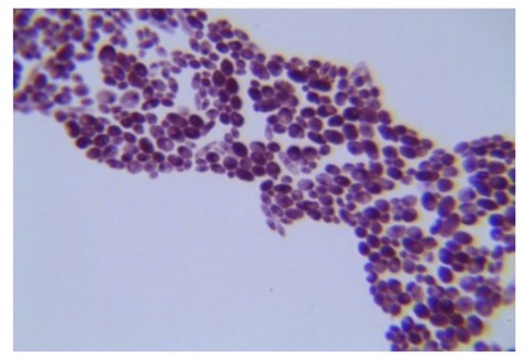 <p>Identify the fungi </p>