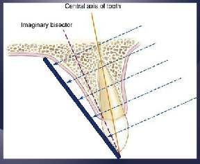 <p>The central ray is directed at a right angle to the imaginary plane that bisects the angle formed by the image receptor and the central axis of the object (less frequently used because of more distortion)</p>