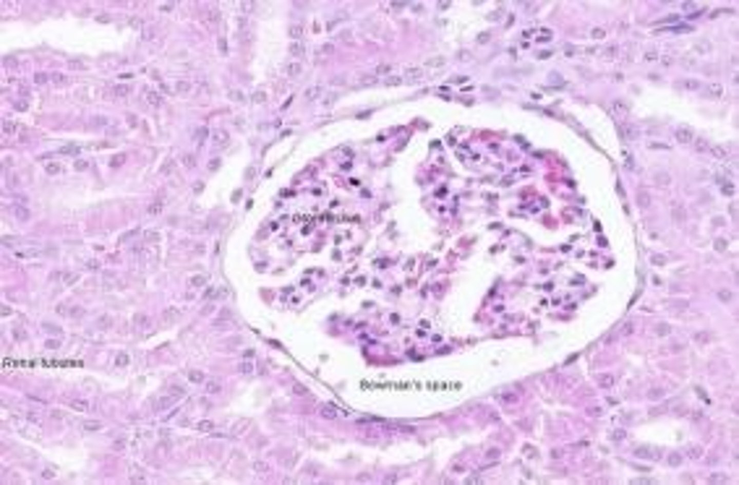 <p>Bowman space.</p>