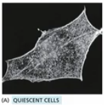 <p>normal Rho family GTPase activation (normal actin behaviour, cell movement), healthy balance b/w members</p><p>cell in interphase</p>