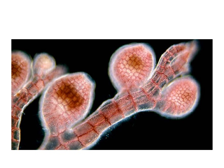 <p>What generations are visible on this slide? Select all that apply.</p><p>Male gametophyte</p><p>Tetrasporophyte</p><p>Carposporophyte</p><p>Female gametophyte</p>