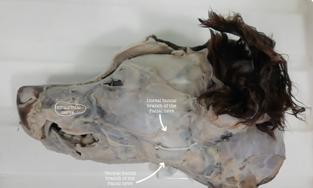 <p>Dorsal buccal branch of the Facial nerve</p><p>Ventral buccal branch of the Facial nerve</p><p>Infraorbital nerve</p>